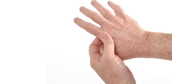 Arthritis Quizzes, Arthritis Trivia, Arthritis Questions
