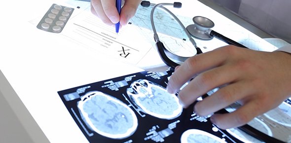 Epilepsy Quizzes, Epilepsy Trivia, Epilepsy Questions