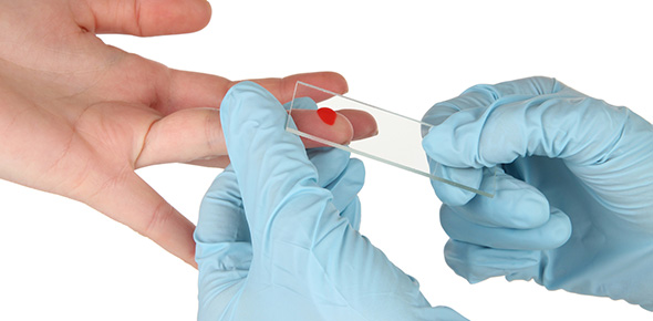 Malaria Quizzes, Malaria Trivia, Malaria Questions