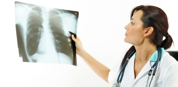 Pneumonia Quizzes, Pneumonia Trivia, Pneumonia Questions