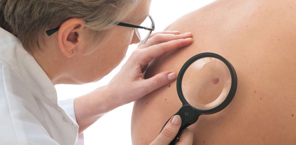 Skin Cancer Quizzes, Skin cancer Trivia, Skin cancer Questions