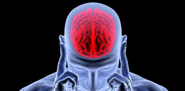 Stroke Quizzes, Stroke Trivia, Stroke Questions