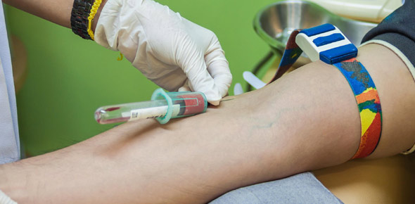 Phlebotomy Quizzes, Phlebotomy Trivia, Phlebotomy Questions