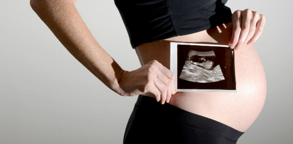 Sonography Quizzes, Sonography Trivia, Sonography Questions
