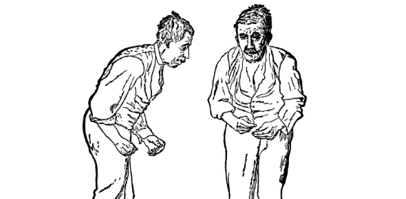 Parkinson Disease Quizzes, Parkinson disease Trivia, Parkinson disease Questions